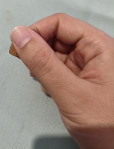 Yema_lateral índice 1.jpg