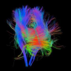 Life and Death 3000.jpg