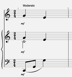 ejemplo multivoz.png