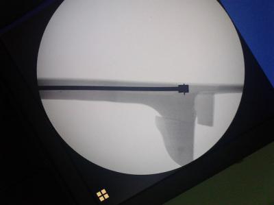 rdx mastil puesnte.jpg