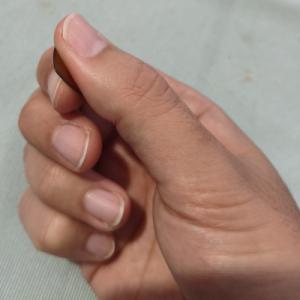 Yema_lateral índice 3.jpg